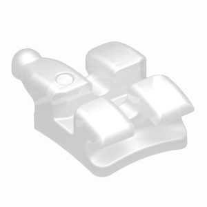 Alternative view of iD-Logical Ceramic Aesthetic Brackets - Roth Technique