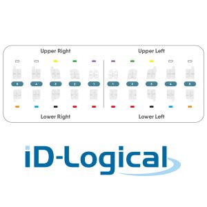 Alternative view of iD-Logical LUCEM Ceramic Aesthetic Brackets - Roth Technique with hooks