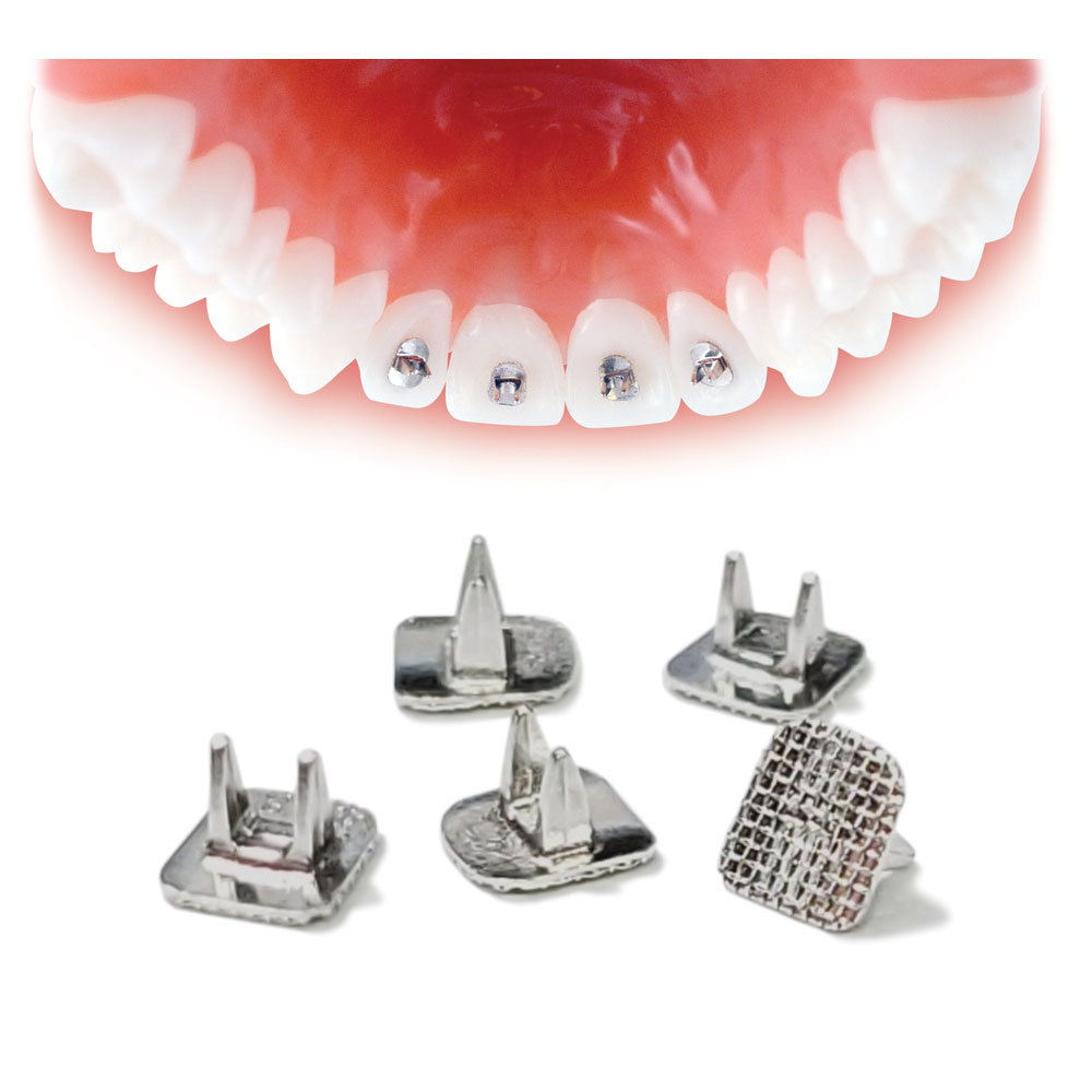 Tongue Tamers Orthodontic Supply & Equipment Company