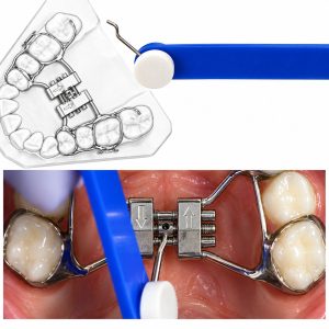 Leone Stealth Rapid Palatal Expander – Orthodontic Supply