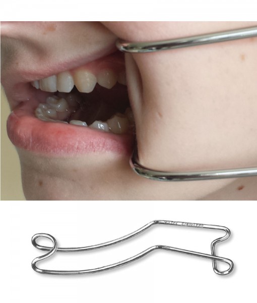 Double Ended Stainless Steel Cheek Retractor Orthodontic Supply