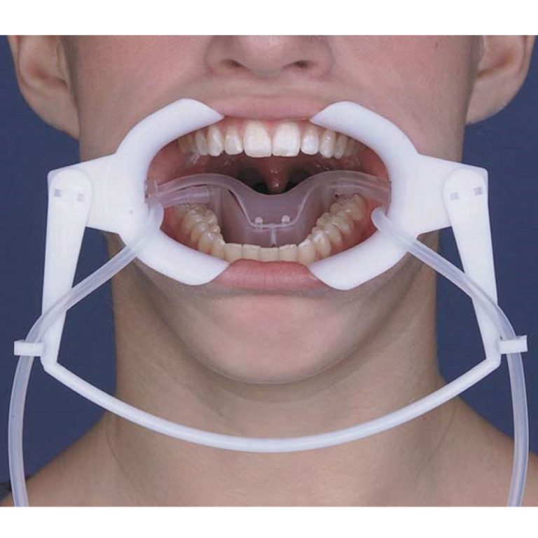 Lip Ring Retractor Orthodontic Supply & Equipment Company