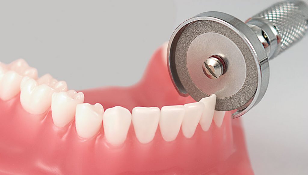 Galaxy Diamond Discs and Safety Guards Orthodontic Supply & Equipment