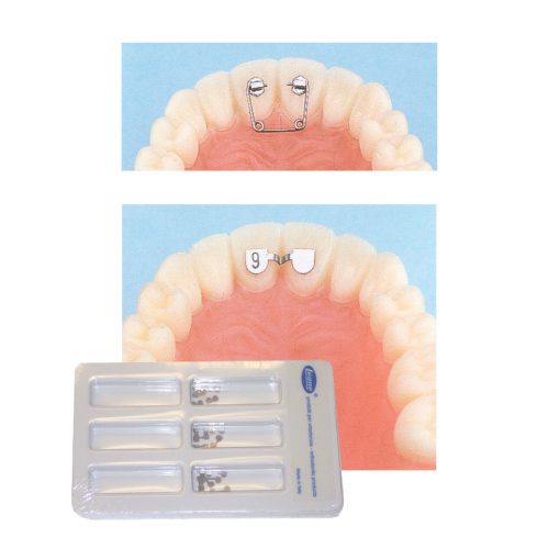 Diastema Closure Kit and Direct Bond Retainers