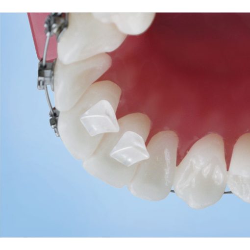Bite Builder Orthodontic Bite Opener - Image 3