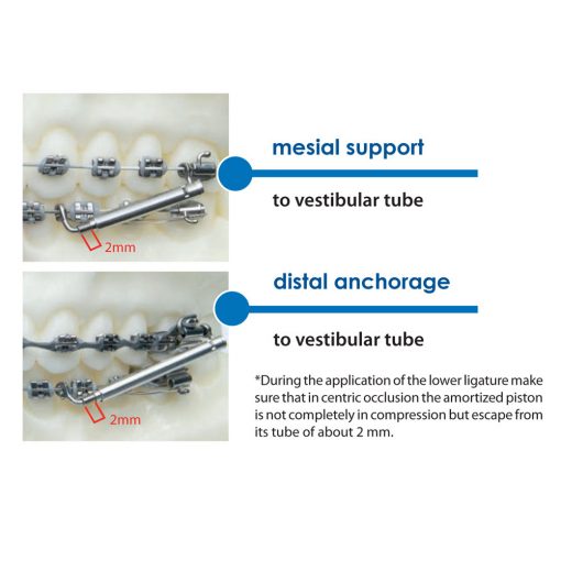 Go-To-One Class ll Corrector - Image 3