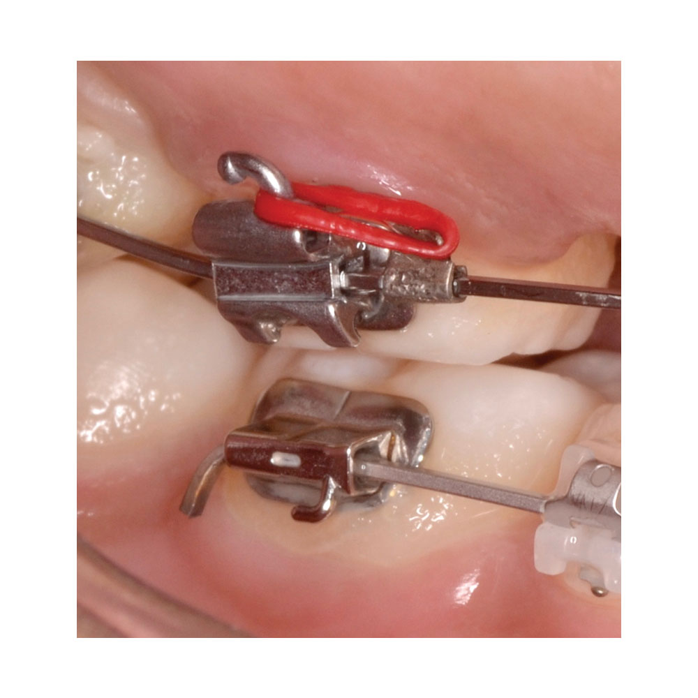 Diamond Crimp Tie Backs - Image 3