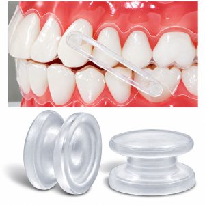 OrthoFlex Round Composite Buttons