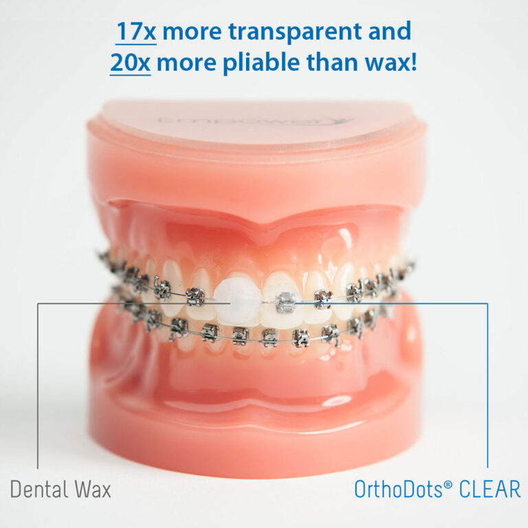 Lip Bumper Tubing Orthodontic Supply & Equipment Company