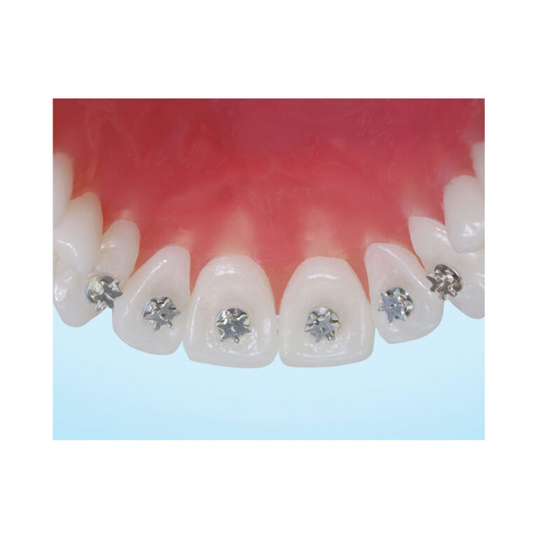 Tongue Tamers PLUS Orthodontic Supply & Equipment Company