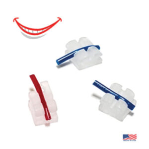 SuperSmile Ceramic Brackets